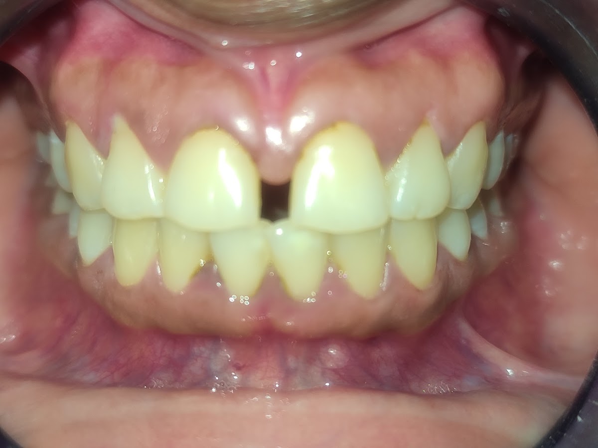 OVI Dental Rahatterpul / অভি ডেন্টাল রাহাত্তারপুল - Photo 1